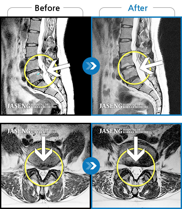 ȭڻѹ溴 ġ MRI  ġ-㸮  , ٸ ٱ   ߴ. 