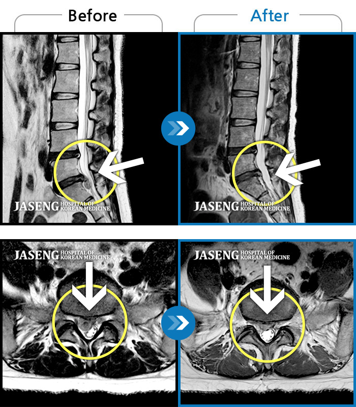 ȭڻѹ溴 ġ MRI  ġ- 㸮   ϰ ٸ  㸮 ȹٷ  . 