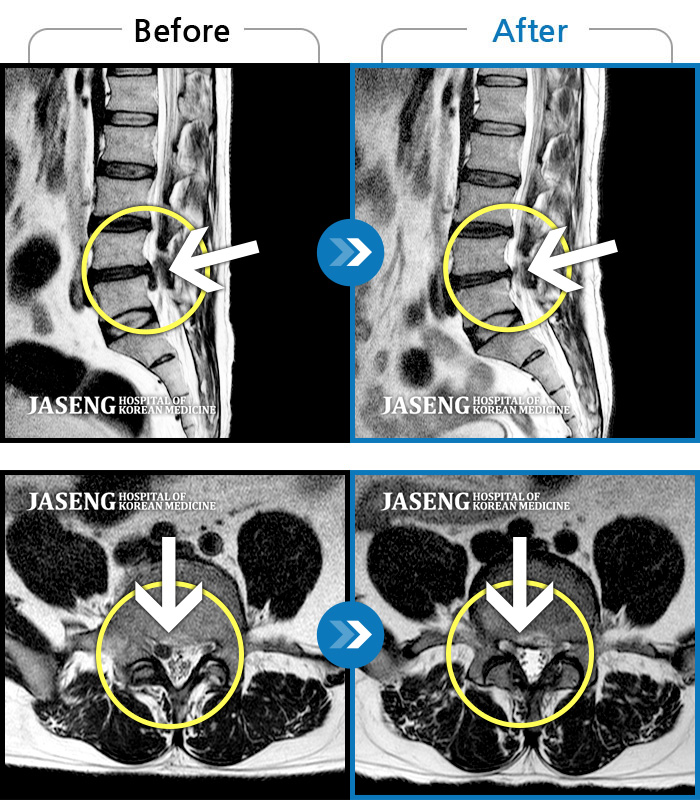 ûڻѹ溴 ġ MRI  ġ-   ġ  Ƹ   Ͽ ϻȰ ȵǴ · ϼ̴ Դϴ.