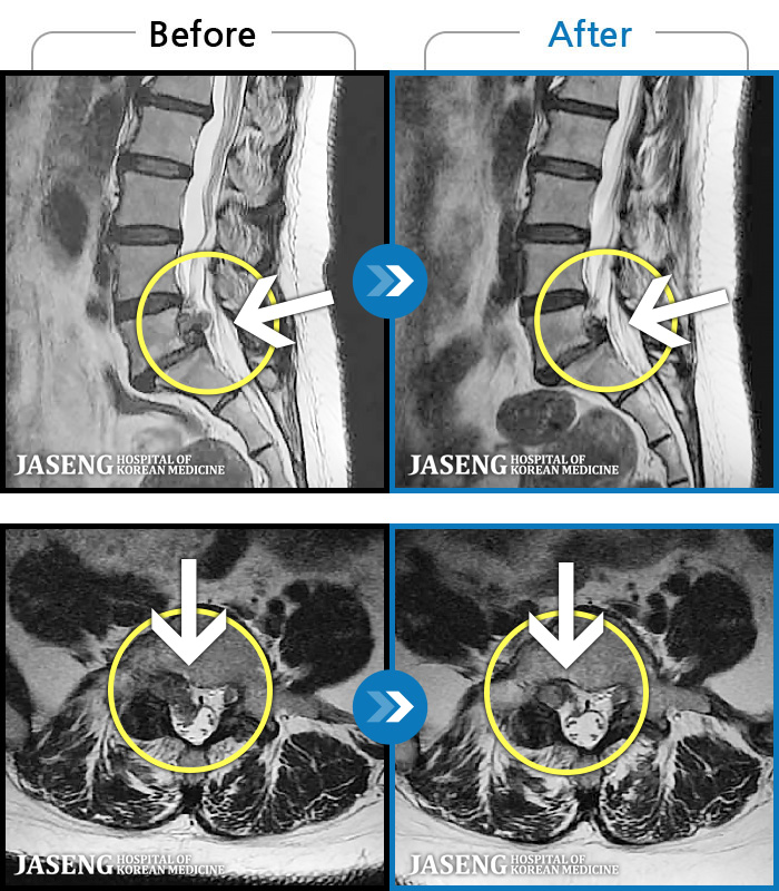 ڻѹ溴 ġ MRI ġ- ġ ƻ ȵ.