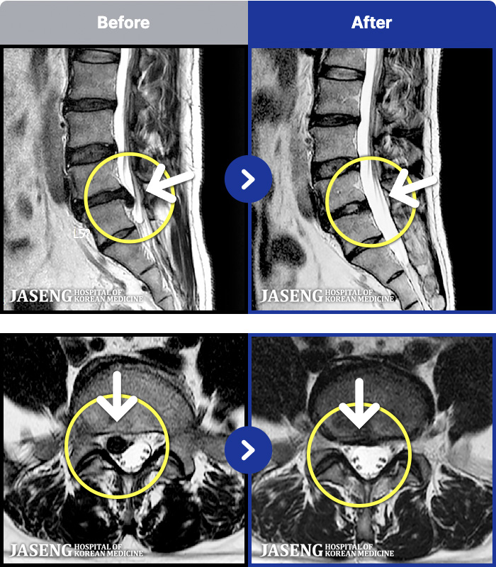 �����ڻ����ǿ� ġ���� MRI�� ���� ġ����-�㸮 ����� ������ ������ ���Ƹ� �ٱ������� ������ ������ �̻��ϰ�, �ٸ��� ��� �����