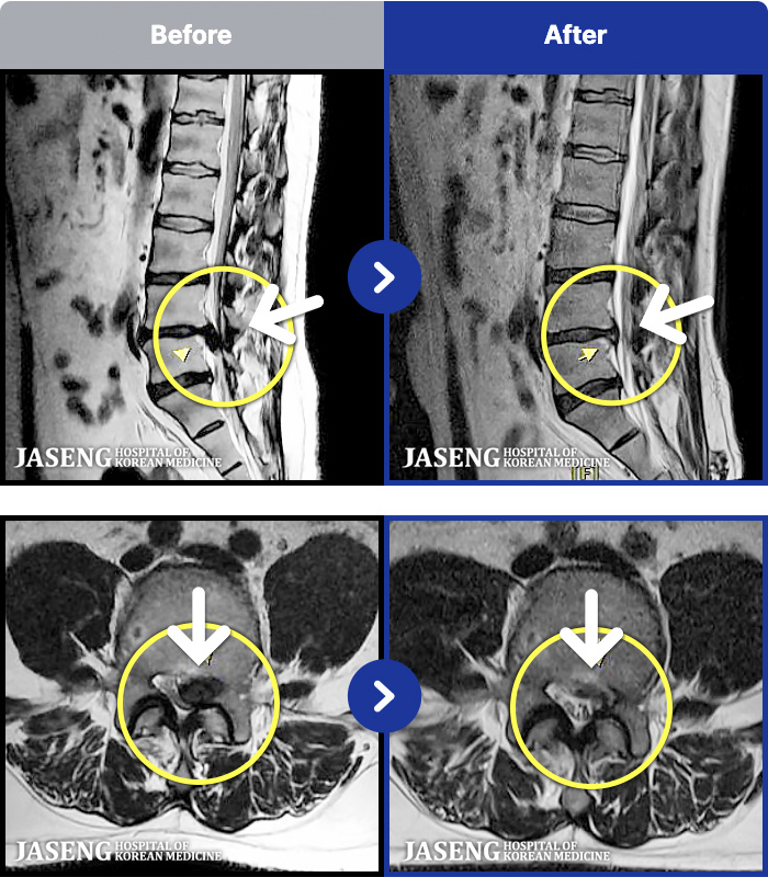 �����ڻ����ǿ� ġ���� MRI�� ���� ġ����-�㸮 ������ ���� �кκ��� �����, �߸� ���� ������ �������� �����ϼ̽��ϴ�.