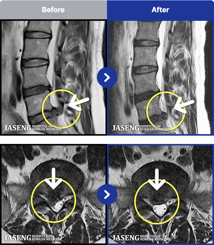 �����ڻ����ǿ� ġ���� MRI�� ���� ġ����-���� ���� �� ���� �����ĸ�� �� ��ü�� ����, �ٷ�����