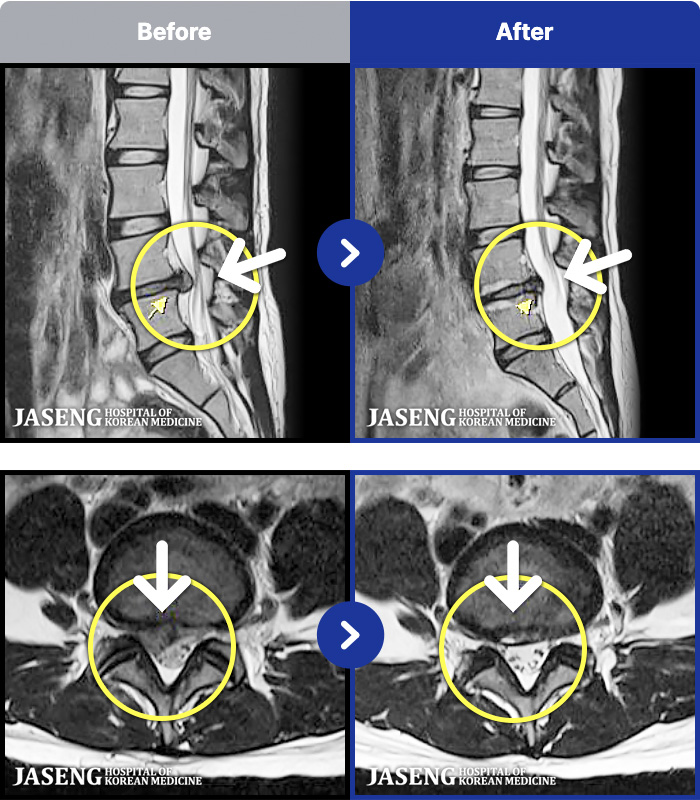 �����ڻ����ǿ� ġ���� MRI�� ���� ġ����-�� 1�� ���� ���� �ʴ� ���� �㸮���� ���, ������������ �̾����� ���� �� �ɾҴ� �Ͼ �� ���� ��ȭ�Ǿ� �����ϼ̽��ϴ�.