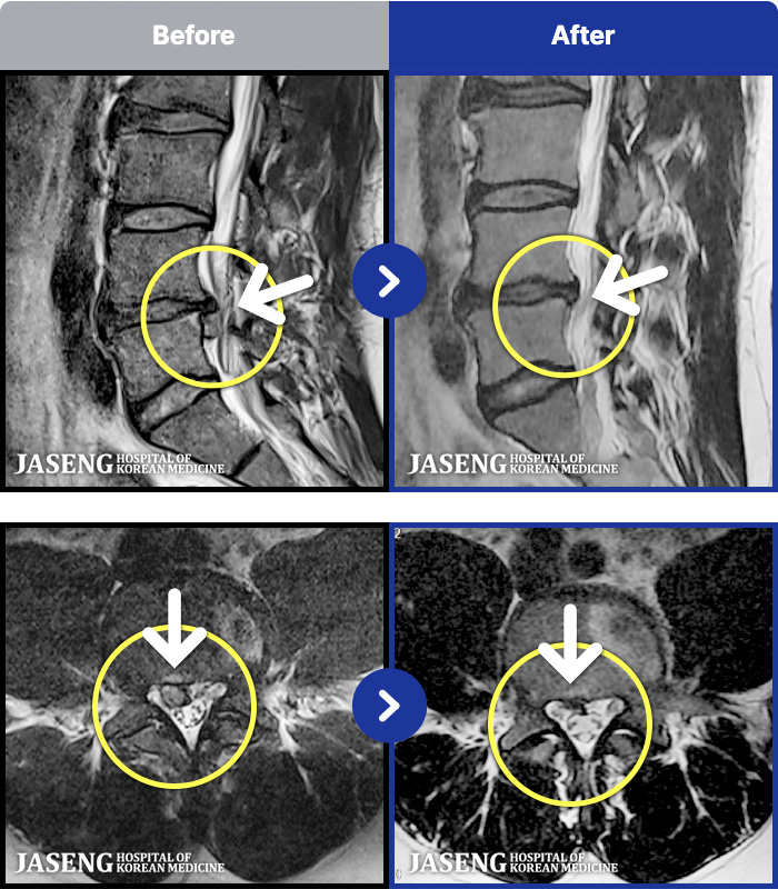 ڻѹ溴 ġ MRI ġ- ϰ ߱ 10̻ .
