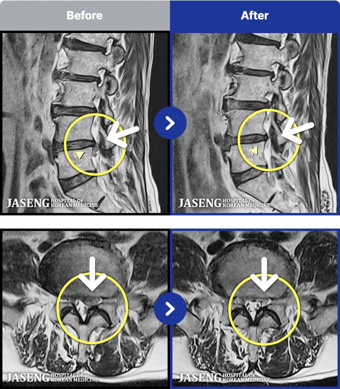 ڻѹ溴 ġ MRI ġ-ð ɰų, Ͼ ݺ ߳ Į ° ־ϴ.
