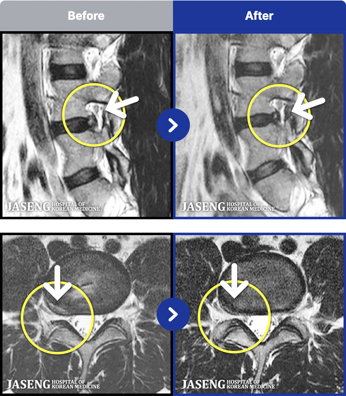 ڻѹ溴 ġ MRI ġ- ٸ 㸮 ȹٷ , Բ 㸮 ־ ߴ.