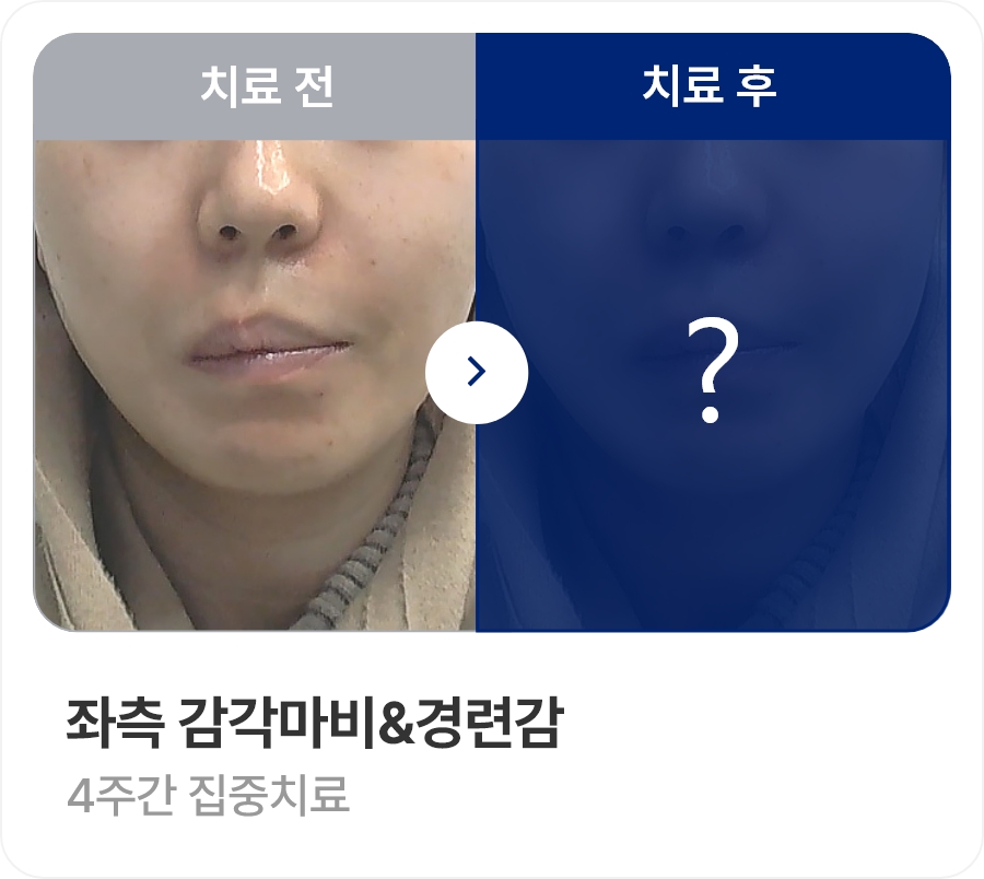 좌측 감각마비&경련감 / 4주간 집중치료